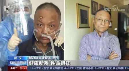 중국 얼굴 검게 변한 코로나 의사 3