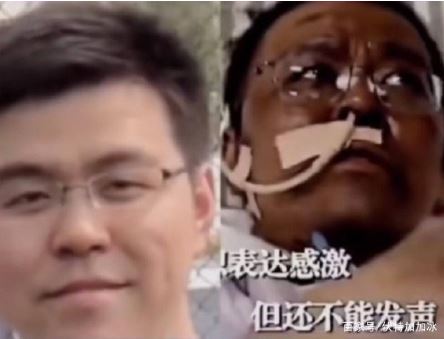 중국 얼굴 검게 변한 코로나 의사 2