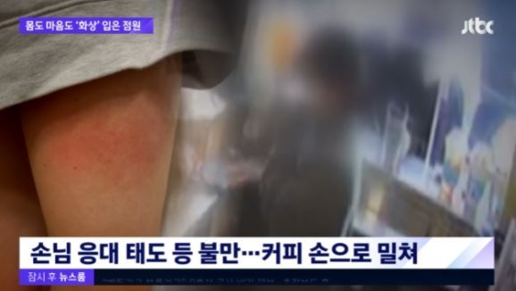 태도왜그래…점원허벅지에뜨거운커피부은손님